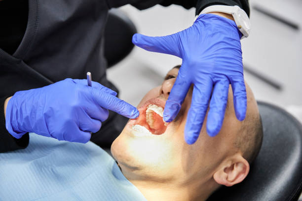 Best Same-Day Emergency Dental Services in St Henry, OH